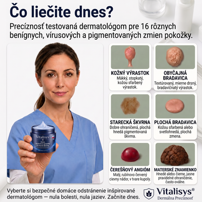 👩‍⚕️🎁Vitalisys® 𝟕-dňový krém na odstránenie kožných výrastkov a škvŕn (bezbolestná formula – bez jaziev) 🎀