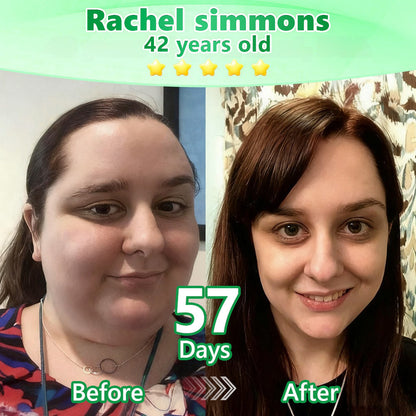 𝐎𝐟𝐟𝐢𝐜𝐢𝐚𝐥 Ireland 𝐂𝐞𝐫𝐭𝐢𝐟𝐢𝐞𝐝 𝐋𝐨𝐭𝐦𝐚𝐲® GLP-1 6-in-1 Oral Liquid  Supports weight management, heart & vascular health, blood sugar balance, sleep quality, joint flexibility, and overall wellbeing