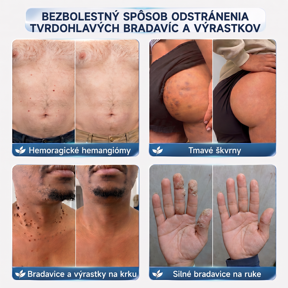 👩‍⚕️🎁Vitalisys® 𝟕-dňový krém na odstránenie kožných výrastkov a škvŕn (bezbolestná formula – bez jaziev) 🎀