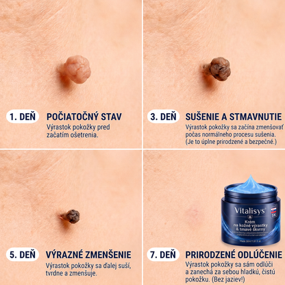 👩‍⚕️🎁Vitalisys® 𝟕-dňový krém na odstránenie kožných výrastkov a škvŕn (bezbolestná formula – bez jaziev) 🎀