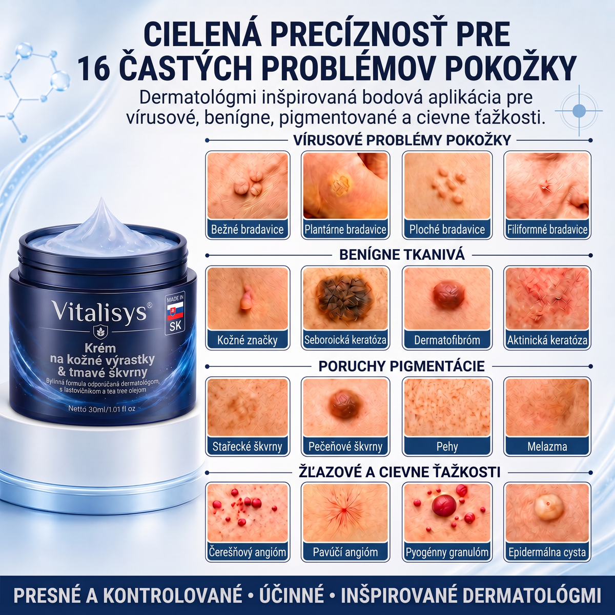 👩‍⚕️🎁Vitalisys® 𝟕-dňový krém na odstránenie kožných výrastkov a škvŕn (bezbolestná formula – bez jaziev) 🎀