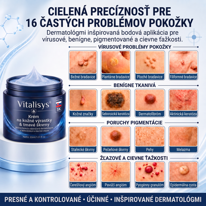 👩‍⚕️🎁Vitalisys® 𝟕-dňový krém na odstránenie kožných výrastkov a škvŕn (bezbolestná formula – bez jaziev) 🎀