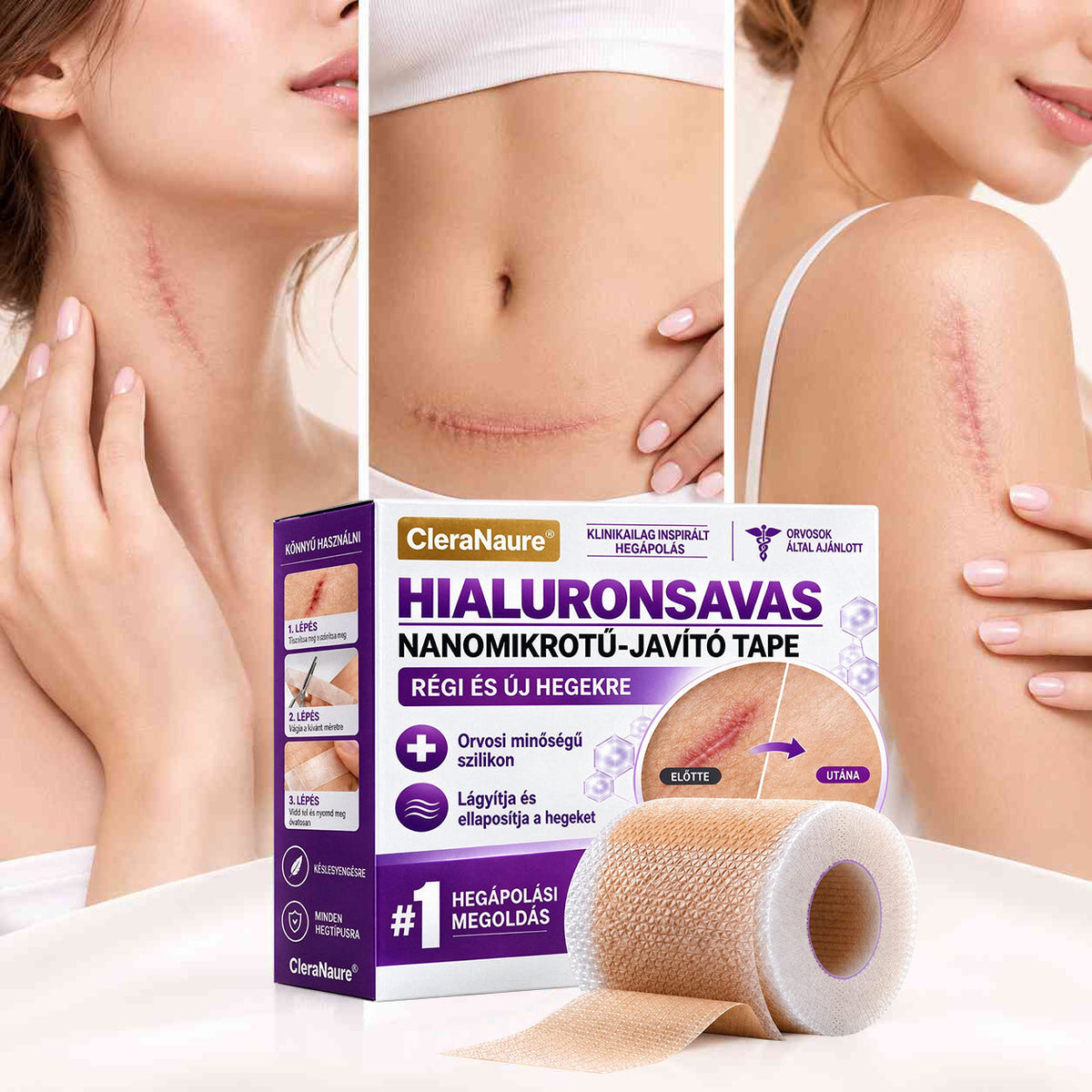 Vitalisys® Hyaluronsavas Nanomikrotű-hegjavító Tapasz