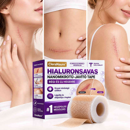 Vitalisys® Hyaluronsavas Nanomikrotű-hegjavító Tapasz