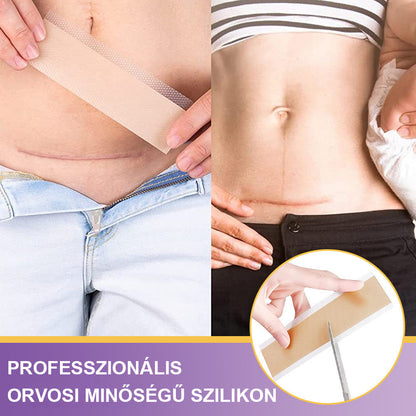 Vitalisys® Hyaluronsavas Nanomikrotű-hegjavító Tapasz